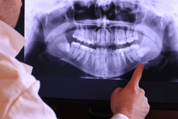 Best Chipped Tooth Repair Near Me  in Gananda, NY